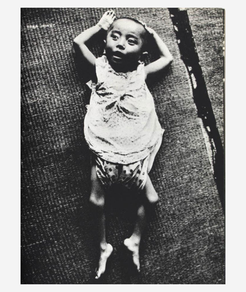 Minamata Disease 1960-70 by Shisei Kuwabara}