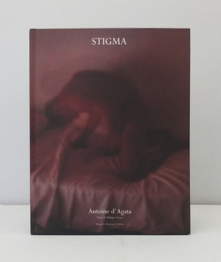 Stigma by Antoine d'Agata}