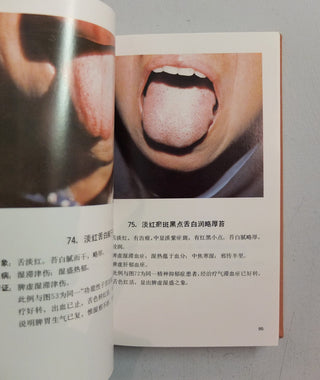 Catalogue of Tongue Coating Diagnoses in Chinese Medicine by People's Medical Publishing House}